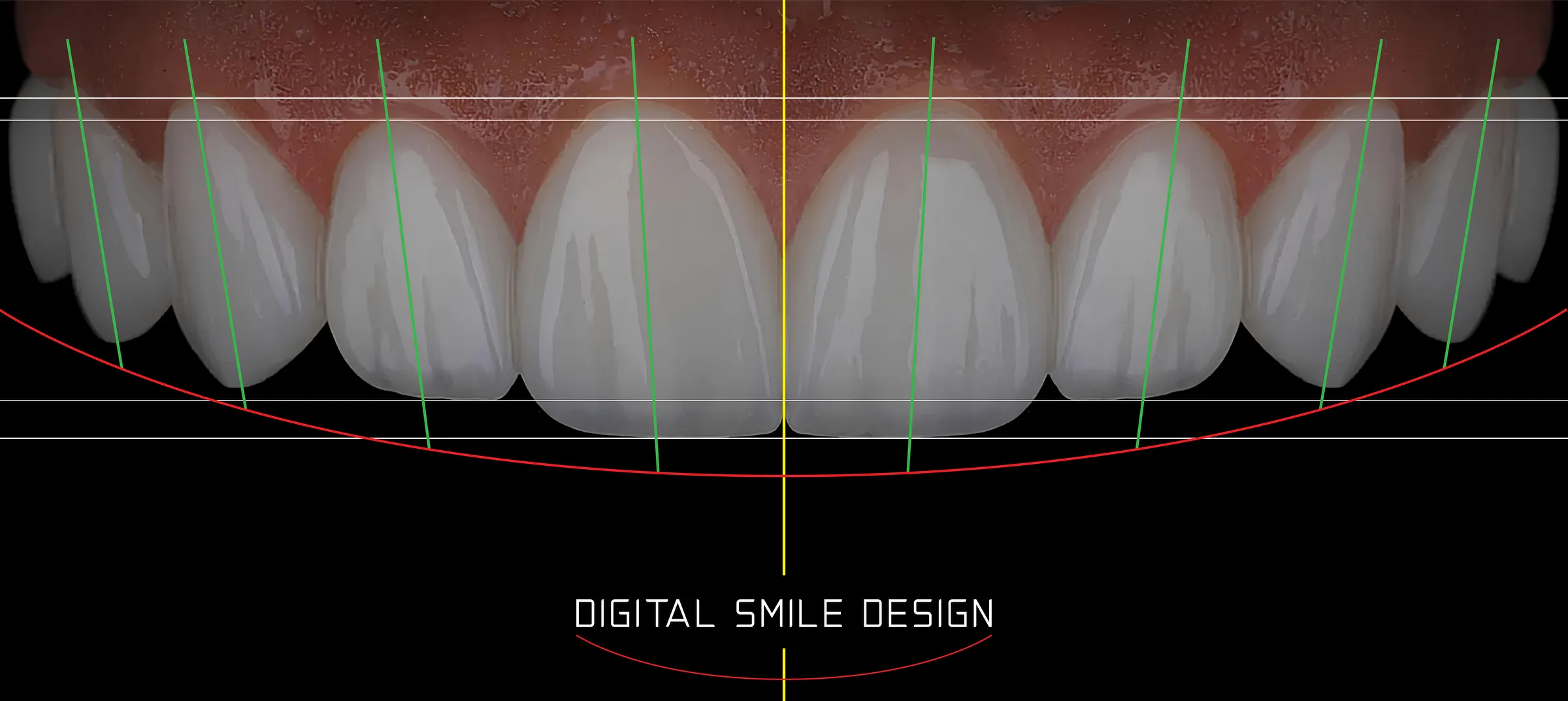 Digital Smile Design in Riverside, CA | Lifetime Dental